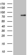 CLINT1 Antibody - HEK293T cells were transfected with the pCMV6-ENTRY control (Left lane) or pCMV6-ENTRY CLINT1 (Right lane) cDNA for 48 hrs and lysed. Equivalent amounts of cell lysates (5 ug per lane) were separated by SDS-PAGE and immunoblotted with anti-CLINT1.