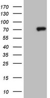 CLINT1 Antibody - HEK293T cells were transfected with the pCMV6-ENTRY control. (Left lane) or pCMV6-ENTRY CLINT1. (Right lane) cDNA for 48 hrs and lysed. Equivalent amounts of cell lysates. (5 ug per lane) were separated by SDS-PAGE and immunoblotted with anti-CLINT1.