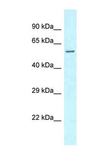 CLINT1 Antibody - CLINT1 antibody Western blot of Fetal Lung lysate. Antibody concentration 1 ug/ml.  This image was taken for the unconjugated form of this product. Other forms have not been tested.