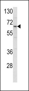 CLINT1 Antibody - Western blot of ENTH Antibody in HL-60 cell line lysates (35 ug/lane). ENTH (arrow) was detected using the purified antibody.