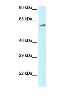 CLINT1 Antibody - CLINT1 antibody Western blot of Jurkat Cell lysate. Antibody concentration 1 ug/ml.  This image was taken for the unconjugated form of this product. Other forms have not been tested.