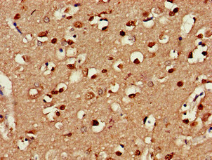 CLINT1 Antibody - Immunohistochemistry of paraffin-embedded human brain tissue at dilution of 1:100
