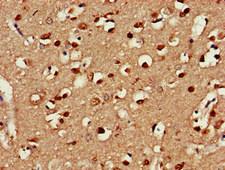 CLINT1 Antibody - Immunohistochemistry of paraffin-embedded human brain tissue at dilution of 1:100