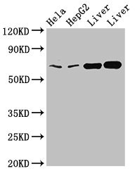 CLINT1 Antibody - Western Blot Positive WB detected in:Hela whole cell lysate,HepG2 whole cell lysate,Rat liver tissue,Mouse liver tissue All Lanes:CLINT1 antibody at 2µg/ml Secondary Goat polyclonal to rabbit IgG at 1/50000 dilution Predicted band size: 69,71 KDa Observed band size: 69 KDa