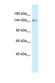 CLIP1 / CLIP-170 Antibody - CLIP1 / CLIP170 antibody Western blot of Fetal Liver lysate. Antibody concentration 1 ug/ml.  This image was taken for the unconjugated form of this product. Other forms have not been tested.