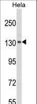 CLIP1 / CLIP-170 Antibody - Western blot of CLIP1 Antibody in HeLa cell line lysates (35 ug/lane). CLIP1 (arrow) was detected using the purified antibody.