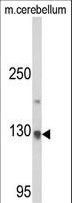 CLIP1 / CLIP-170 Antibody - Western blot of CLIP1 Antibody in mouse cerebellum tissue lysates (35 ug/lane). CLIP1 (arrow) was detected using the purified antibody.