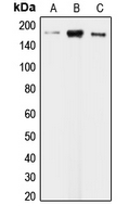 CLIP1 / CLIP-170 Antibody - Western blot analysis of CLIP1 expression in KNRK (A); HeLa (B); HepG2 (C) whole cell lysates.