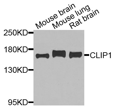 CLIP1 / CLIP-170 Antibody - Western blot analysis of extracts of various cells.