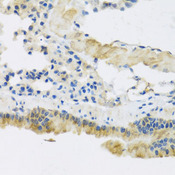 CLIP1 / CLIP-170 Antibody - Immunohistochemistry of paraffin-embedded mouse lung tissue.