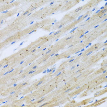 CLIP1 / CLIP-170 Antibody - Immunohistochemistry of paraffin-embedded rat heart.