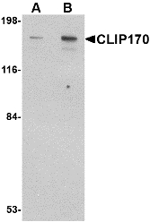CLIP1 / CLIP-170 Antibody - Western blot of CLIP170 in rat brain tissue lysate with CLIP170 antibody at (A) 0.5 and (B) 1 ug/ml.