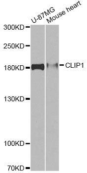 CLIP1 / CLIP-170 Antibody - Western blot analysis of extracts of various cell lines, using CLIP1 antibody at 1:1000 dilution. The secondary antibody used was an HRP Goat Anti-Rabbit IgG (H+L) at 1:10000 dilution. Lysates were loaded 25ug per lane and 3% nonfat dry milk in TBST was used for blocking. An ECL Kit was used for detection and the exposure time was 60s.