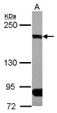 CLIP1 / CLIP-170 Antibody - Sample (30 ug of whole cell lysate) A: A431 5% SDS PAGE CLIP1 / CLIP170 antibody diluted at 1:1000