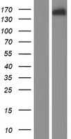 CLIP1 / CLIP-170 Protein - Western validation with an anti-DDK antibody * L: Control HEK293 lysate R: Over-expression lysate