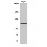 CLIP2 / CYLN2 Antibody - Western blot of CLIP-115 antibody