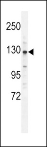 CLIP2 / CYLN2 Antibody - CYLN2 Antibody western blot of mouse brain tissue lysates (35 ug/lane). The CYLN2 antibody detected the CYLN2 protein (arrow).