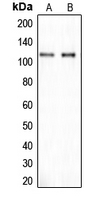 CLIP2 / CYLN2 Antibody - Western blot analysis of CLIP2 expression in SHSY5Y (A); A549 (B) whole cell lysates.