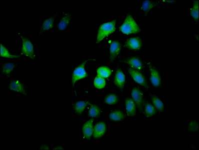 CLIP2 / CYLN2 Antibody - Immunofluorescence staining of A549 cells diluted at 1:166, counter-stained with DAPI. The cells were fixed in 4% formaldehyde, permeabilized using 0.2% Triton X-100 and blocked in 10% normal Goat Serum. The cells were then incubated with the antibody overnight at 4°C.The Secondary antibody was Alexa Fluor 488-congugated AffiniPure Goat Anti-Rabbit IgG (H+L).