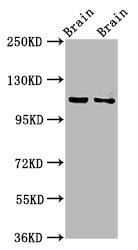 CLIP2 / CYLN2 Antibody - Western Blot Positive WB detected in: Rat brain tissue, Mouse brain tissue All Lanes: CLIP2 antibody at 3.2µg/ml Secondary Goat polyclonal to rabbit IgG at 1/50000 dilution Predicted band size: 116, 112 KDa Observed band size: 116 KDa
