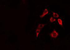 CLIP2 / CYLN2 Antibody - Staining HepG2 cells by IF/ICC. The samples were fixed with PFA and permeabilized in 0.1% Triton X-100, then blocked in 10% serum for 45 min at 25°C. The primary antibody was diluted at 1:200 and incubated with the sample for 1 hour at 37°C. An Alexa Fluor 594 conjugated goat anti-rabbit IgG (H+L) antibody, diluted at 1/600, was used as secondary antibody.