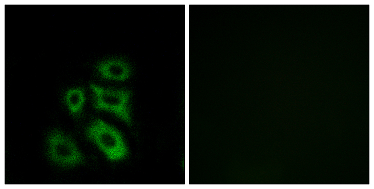 CLIP3 Antibody - Immunofluorescence analysis of A549 cells, using CLIP3 Antibody. The picture on the right is blocked with the synthesized peptide.