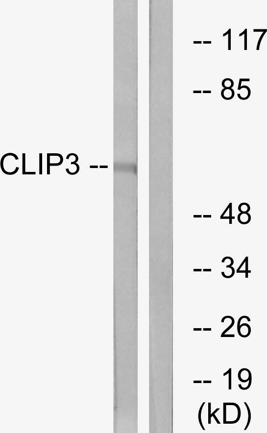 CLIP3 Antibody - Western blot analysis of lysates from A549 cells, using CLIP3 Antibody. The lane on the right is blocked with the synthesized peptide.