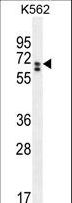 CLIP3 Antibody - CLIP3 Antibody western blot of K562 cell line lysates (35 ug/lane). The CLIP3 antibody detected the CLIP3 protein (arrow).