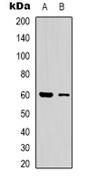 CLIP3 Antibody - Western blot analysis of CLIP3 expression in human brain (A); A549 (B) whole cell lysates.
