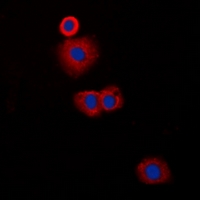 CLIP3 Antibody - Immunofluorescent analysis of CLIP3 staining in A549 cells. Formalin-fixed cells were permeabilized with 0.1% Triton X-100 in TBS for 5-10 minutes and blocked with 3% BSA-PBS for 30 minutes at room temperature. Cells were probed with the primary antibody in 3% BSA-PBS and incubated overnight at 4 deg C in a humidified chamber. Cells were washed with PBST and incubated with a DyLight 594-conjugated secondary antibody (red) in PBS at room temperature in the dark. DAPI was used to stain the cell nuclei (blue).