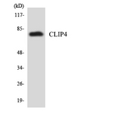 CLIP4 / RSNL2 Antibody - Western blot analysis of the lysates from HUVECcells using CLIP4 antibody.