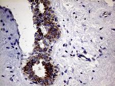 CLIP4 / RSNL2 Antibody - Immunohistochemical staining of paraffin-embedded Human breast tissue within the normal limits using anti-CLIP4 mouse monoclonal antibody. (Heat-induced epitope retrieval by 1mM EDTA in 10mM Tris buffer. (pH8.5) at 120°C for 3 min. (1:500)