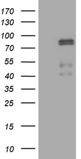 CLIP4 / RSNL2 Antibody - HEK293T cells were transfected with the pCMV6-ENTRY control. (Left lane) or pCMV6-ENTRY CLIP4. (Right lane) cDNA for 48 hrs and lysed. Equivalent amounts of cell lysates. (5 ug per lane) were separated by SDS-PAGE and immunoblotted with anti-CLIP4. (1:2000)