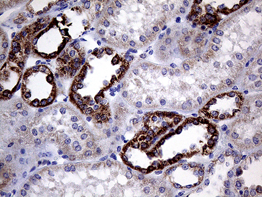 CLIP4 / RSNL2 Antibody - Immunohistochemical staining of paraffin-embedded Human Kidney tissue within the normal limits using anti-CLIP4 mouse monoclonal antibody. (Heat-induced epitope retrieval by 1mM EDTA in 10mM Tris buffer. (pH8.5) at 120°C for 3 min. (1:500)