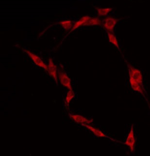 CLIP4 / RSNL2 Antibody - Staining HepG2 cells by IF/ICC. The samples were fixed with PFA and permeabilized in 0.1% Triton X-100, then blocked in 10% serum for 45 min at 25°C. The primary antibody was diluted at 1:200 and incubated with the sample for 1 hour at 37°C. An Alexa Fluor 594 conjugated goat anti-rabbit IgG (H+L) Ab, diluted at 1/600, was used as the secondary antibody.