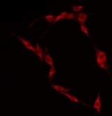 CLIP4 / RSNL2 Antibody - Staining HepG2 cells by IF/ICC. The samples were fixed with PFA and permeabilized in 0.1% Triton X-100, then blocked in 10% serum for 45 min at 25°C. The primary antibody was diluted at 1:200 and incubated with the sample for 1 hour at 37°C. An Alexa Fluor 594 conjugated goat anti-rabbit IgG (H+L) Ab, diluted at 1/600, was used as the secondary antibody.
