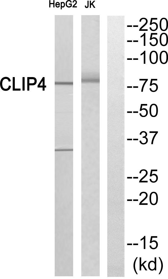 CLIP4 / RSNL2 Antibody - Western blot analysis of extracts from HepG2 cells and Jurkat cells, using CLIP4antibody.