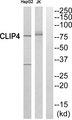 CLIP4 / RSNL2 Antibody - Western blot analysis of extracts from HepG2 cells and Jurkat cells, using CLIP4antibody.