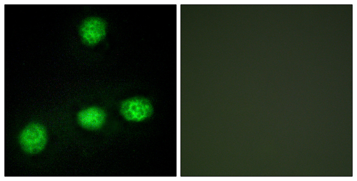 CLK1 / CLK Antibody - Immunofluorescence analysis of HUVEC cells, using CLK1 Antibody. The picture on the right is blocked with the synthesized peptide.