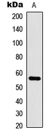 CLK1 / CLK Antibody - Western blot analysis of CLK1 expression in HL60 (A) whole cell lysates.