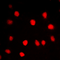 CLK1 / CLK Antibody - Immunofluorescent analysis of CLK1 staining in HUVEC cells. Formalin-fixed cells were permeabilized with 0.1% Triton X-100 in TBS for 5-10 minutes and blocked with 3% BSA-PBS for 30 minutes at room temperature. Cells were probed with the primary antibody in 3% BSA-PBS and incubated overnight at 4 C in a humidified chamber. Cells were washed with PBST and incubated with a DyLight 594-conjugated secondary antibody (red) in PBS at room temperature in the dark. DAPI was used to stain the cell nuclei (blue).