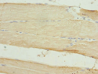 CLK1 / CLK Antibody - Immunohistochemistry of paraffin-embedded human skeletal muscle tissue at dilution 1:100