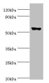 CLK2 Antibody - Western blot All lanes: CLK2 antibody at 5µg/ml + Hela whole cell lysate Secondary Goat polyclonal to rabbit IgG at 1/10000 dilution Predicted band size: 61, 18, 60 kDa Observed band size: 61 kDa