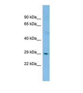 CLK2 Antibody - Western blot of Human ACHN. CLK2 antibody dilution 1.0 ug/ml.  This image was taken for the unconjugated form of this product. Other forms have not been tested.