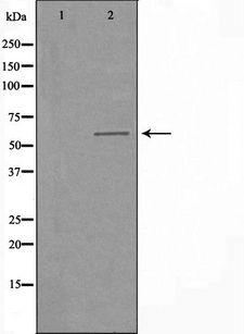 CLK2 Antibody - Western blot analysis of extracts of COLO205 cells using CLK2 antibody. The lane on the left is treated with the antigen-specific peptide.