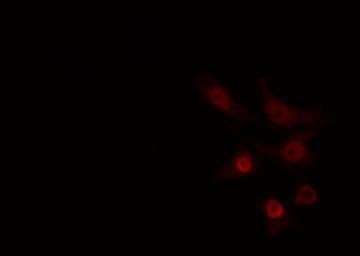 CLK2 Antibody - Staining COLO205 cells by IF/ICC. The samples were fixed with PFA and permeabilized in 0.1% Triton X-100, then blocked in 10% serum for 45 min at 25°C. The primary antibody was diluted at 1:200 and incubated with the sample for 1 hour at 37°C. An Alexa Fluor 594 conjugated goat anti-rabbit IgG (H+L) antibody, diluted at 1/600, was used as secondary antibody.
