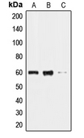 CLK2 Antibody - Western blot analysis of CLK2 expression in HL60 (A); HeLa (B); HepG2 (C) whole cell lysates.