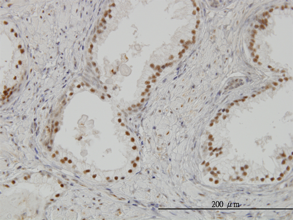 CLK3 Antibody - Immunoperoxidase of monoclonal antibody to CLK3 on formalin-fixed paraffin-embedded human prostate. [antibody concentration 3 ug/ml]