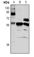 CLK4 Antibody - Western blot analysis of CLK4 expression in HCT116 (A), rat brain (B), mouse brain (C) whole cell lysates.