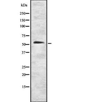 CLK4 Antibody - Western blot analysis of CLK4 using COLO205 whole cells lysates